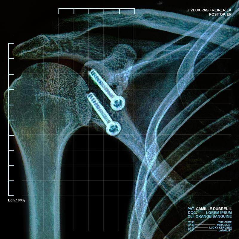 release-cover
